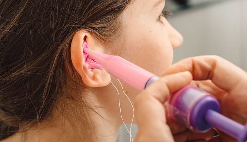 tapones-oido-centro-audiologico-1024x640